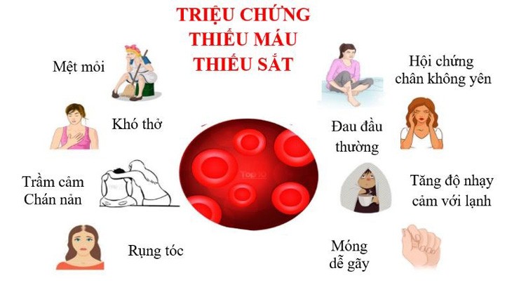 Triệu chứng thiếu máu thiếu sắt